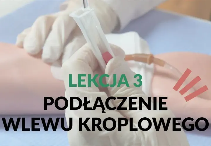 Jak podłączyć kroplówkę instrukcja - uniknij najczęstszych błędów